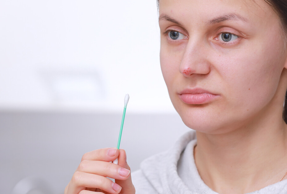 herpes-on-the-nose-pretty-young-woman-woman-hold-2024-10-18-09-31-12-utc (1)